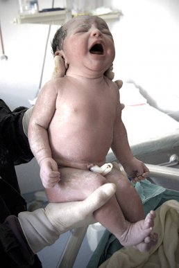 İlkpozlar - Doğum Fotoğrafı